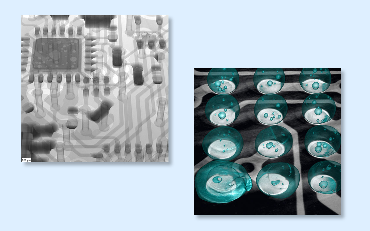 4. 2D vs 3D CT X-ray Which One Do You Really Need? 4. 2D לעומת 3D CT רנטגן איזה מהם אתה באמת צריך?