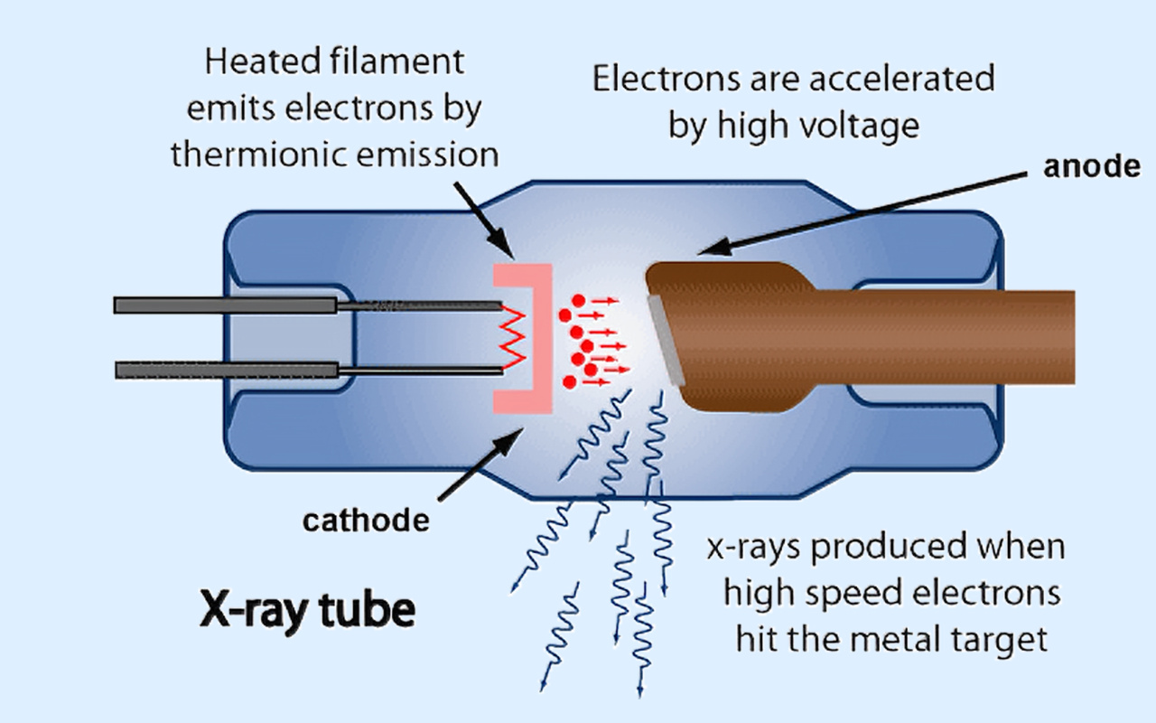 2. What X-ray Technology Actually Does 2. מה בעצם עושה טכנולוגיית רנטגן
