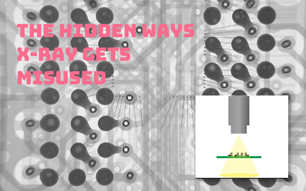 6. טעויות נפוצות בעת שימוש ברנטגן לצמצום חללים